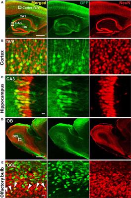 Alternative Anesthesia of Neonatal Mice for Global rAAV Delivery in the Brain With Non-detectable Behavioral Interference in Adults